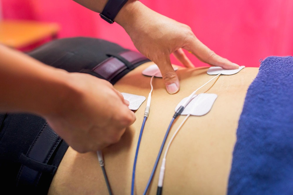 Exercises for Back Pain Relief | Close-up of a physiotherapist applying electrodes for electrotherapy on a patient's back.